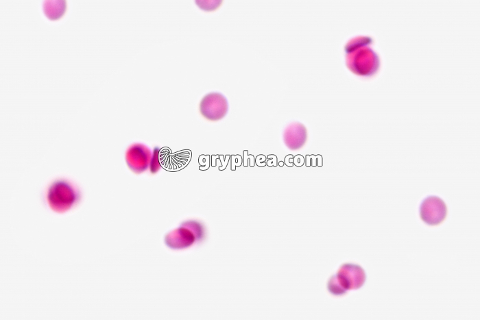 Sang humain hématies libres frottis x200 - gryphea.org